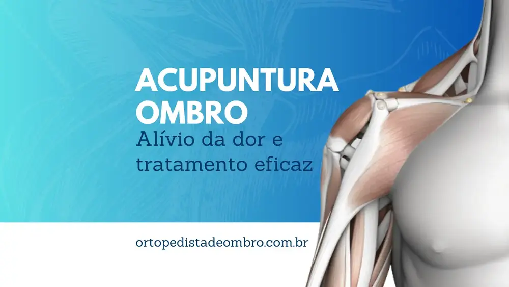 Acupuntura Ombro Alívio da dor e tratamento eficaz