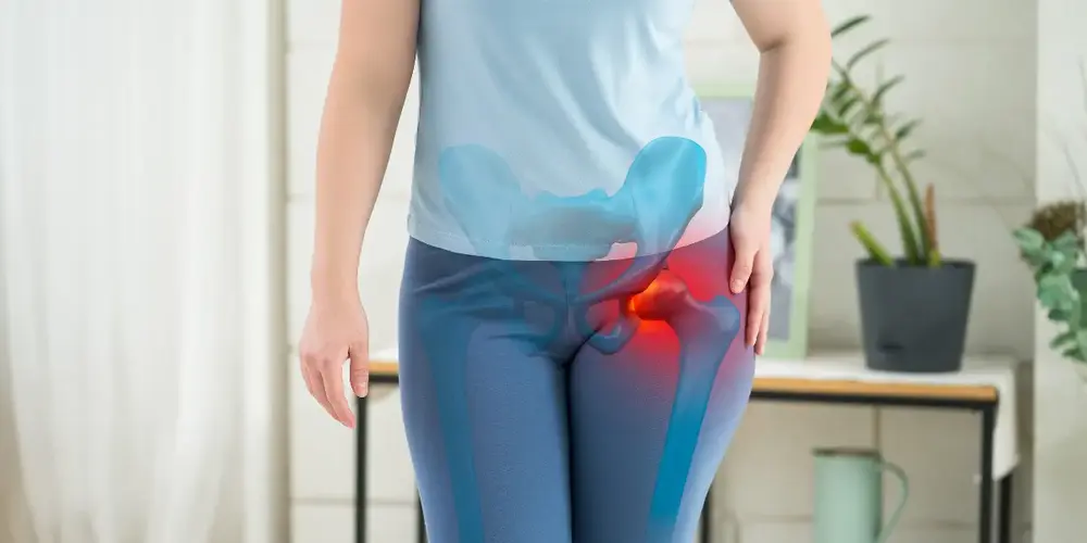 Osteonecrose do quadril