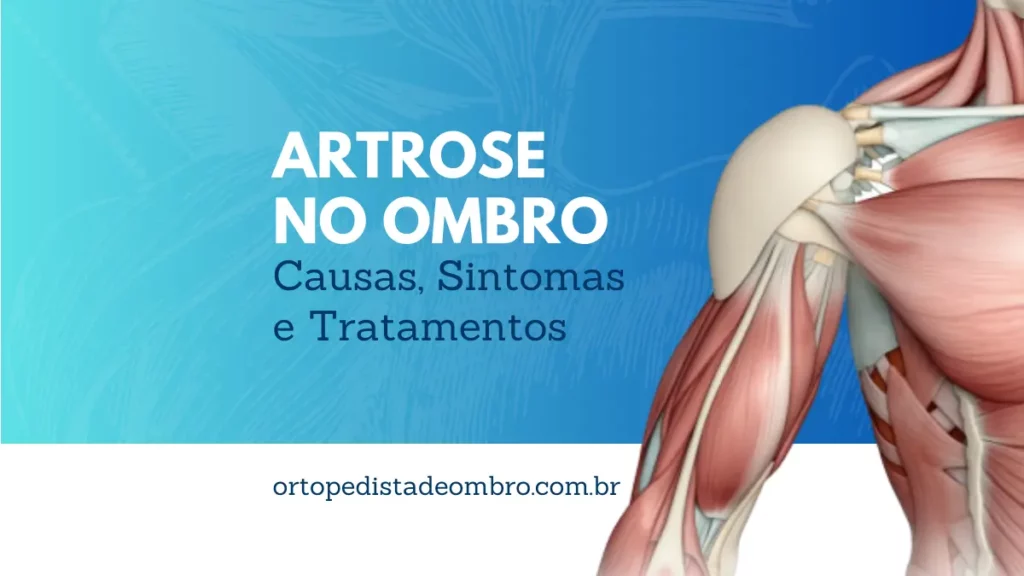 Artrose no Ombro Causas, Sintomas e Tratamentos Disponíveis