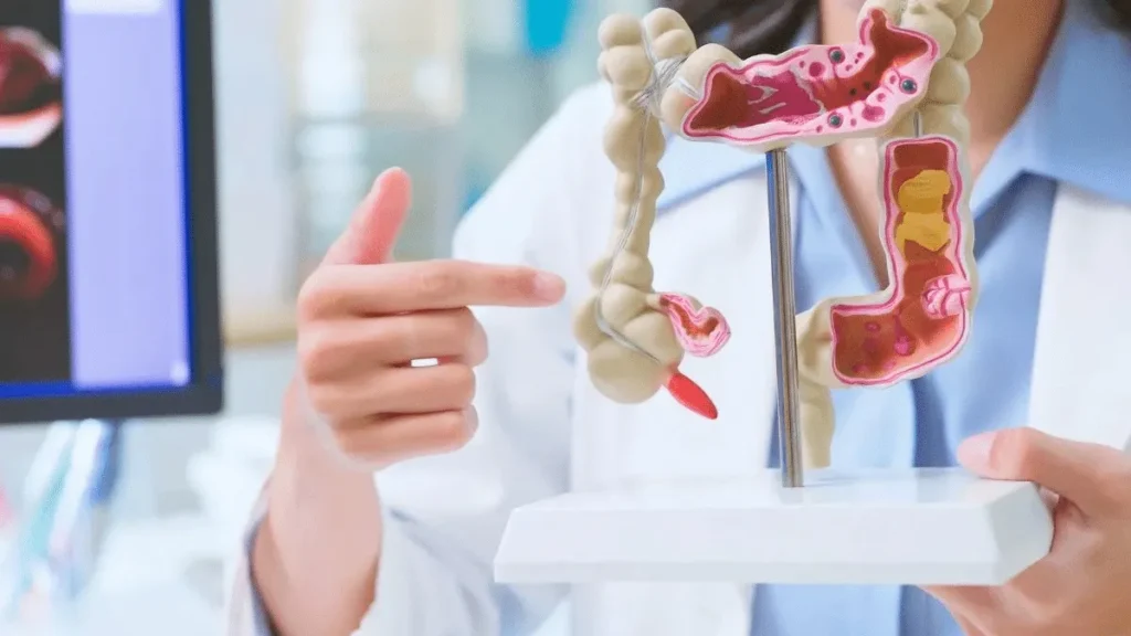 Recupere a flora intestinal em 30 dias, diz gastroenterologista Recupere a flora intestinal em 30 dias, diz gastroenterologista